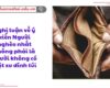 Nghị luận về ý kiến Người nghèo nhất không phải là người không có một xu dính túi